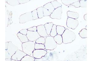 Immunohistochemistry of paraffin-embedded rat skeletal muscle using Dystrophin Rabbit mAb (ABIN7266871) at dilution of 1:100 (40x lens). (Dystrophin antibody)