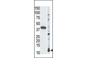 Image no. 1 for anti-Small Ubiquitin Related Modifier Protein 1 (SUMO1) antibody (ABIN356806) (SUMO1 antibody)