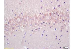 Formalin-fixed and paraffin embedded rat brain labeled with Anti-P53(wt-p53) Polyclonal Antibody, Unconjugated (ABIN677408) at 1:200 followed by conjugation to the secondary antibody and DAB staining. (p53 antibody  (AA 301-393))