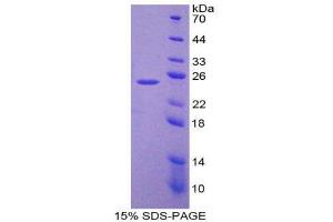 SDS-PAGE (SDS) image for Laminin, beta 3 (LAMB3) (AA 367-568) protein (His tag) (ABIN1879742) (Laminin beta 3 Protein (AA 367-568) (His tag))