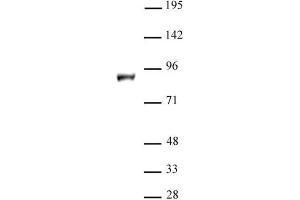 KDM1B / LSD2 antibody (pAb) tested by Western blot. (KDM1B antibody  (N-Term))