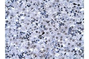 FOXG1A antibody was used for immunohistochemistry at a concentration of 4-8 ug/ml to stain Hepatocyte (arrows) in Human Liver. (FOXG1 antibody  (N-Term))