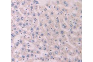 IHC-P analysis of Rat Tissue, with DAB staining. (SERPINC1 antibody  (AA 150-426))