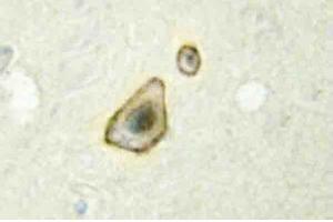 Immunohistochemistry analysis of CYP19A1 Antibody in Paraffin-Embedded Human brain tissue. (Aromatase antibody)