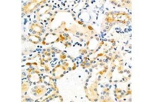 Immunohistochemistry of paraffin embedded mouse kidney using Dmac2l (ABIN7073751) at dilution of 1: 650 (400x lens) (Distal Membrane Arm Assembly Complex 2 L Homeolog (DMAC2.L) antibody)