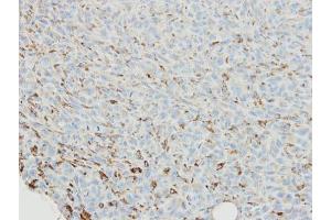 IHC-P Image Immunohistochemical analysis of paraffin-embedded MDAMB231 xenograft, using SNX18, antibody at 1:500 dilution. (SNX18 antibody  (C-Term))