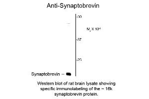 Western blot of Anti-Synaptobrevin (VAMP) (Mouse) Antibody - 200-301-E34 Western Blot of Mouse anti-Synaptobrevin (VAMP) antibody.