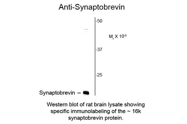 Synaptobrevin (VAMP) Antikörper