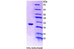 SDS-PAGE (SDS) image for Cellular Repressor of E1A-Stimulated Genes 1 (CREG1) (AA 75-220) protein (His tag) (ABIN4991072) (CREG1 Protein (AA 75-220) (His tag))