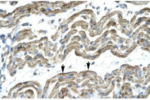 Human Muscle; HumanMuscle; C13ORF8 antibody - middle region in Human Muscle cells using Immunohistochemistry (ZNF828 antibody  (Middle Region))