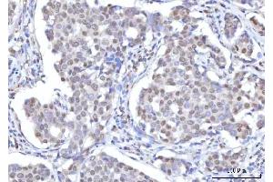 IHC analysis of RANBP2 using anti-RANBP2 antibody (ABIN7602650). (RANBP2 antibody  (AA 906-2744))