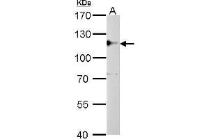 WB Image CYLD antibody detects CYLD protein by Western blot analysis. (CYLD antibody  (C-Term))