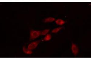 ABIN6274115 staining 293 cells by IF/ICC. (PFKFB2 antibody  (C-Term))