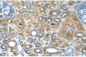 Human kidney (UBXD2 antibody  (Middle Region))