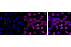 Immunocytochemical staining of C2C12 cells with RELB antibody (ABIN7800804), 1:1,000). (Recombinant RELB antibody)