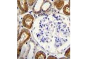 Immunohistochemistry analysis in formalin fixed and paraffin embedded human kidney tissue reacted with OPN-a/b Antibody (N-term) followed by peroxidase conjugation of the secondary antibody and DAB staining.