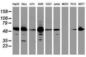 Image no. 1 for anti-Epoxide Hydrolase 1, Microsomal (Xenobiotic) (EPHX1) (AA 21-230) antibody (ABIN1491197) (EPHX1 antibody  (AA 21-230))