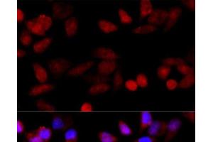Immunofluorescence analysis of HeLa cells using CYP1B1 Polyclonal Antibody at dilution of 1:100 (40x lens).