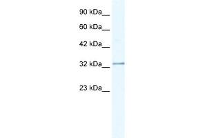 NUDT9 antibody  (C-Term)