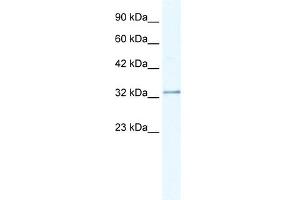 WB Suggested Anti-NUDT9 Antibody Titration:  0. (NUDT9 antibody  (C-Term))