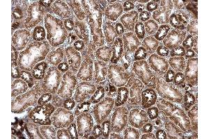 IHC-P Image ROCK2 antibody detects ROCK2 protein at cytosol on mouse kidney by immunohistochemical analysis.