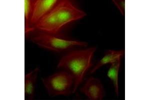 Immunofluorescence of human HeLa cells stained with Phalloidin-TRITC (Red) for Actin staining and monoclonal anti-human UBE2S antibody (1:500) with Alexa 488 (Green). (UBE2S antibody  (AA 1-222))