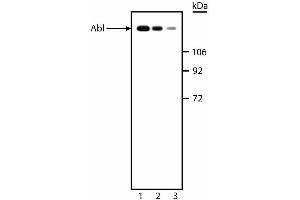 Western blot analysis of Abl. (ABL1 antibody)