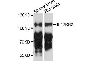 Western blot analysis of extracts of various cell lines, using IL12RB2 antibody (ABIN4904030) at 1:1000 dilution. (IL12RB2 antibody)