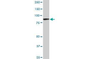 UBTF monoclonal antibody (M05), clone 2C6. (UBTF antibody  (AA 551-650))