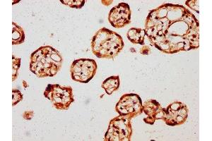 Immunohistochemistry (IHC) image for anti-Angiomotin (AMOT) (AA 1-300) antibody (ABIN7144087)