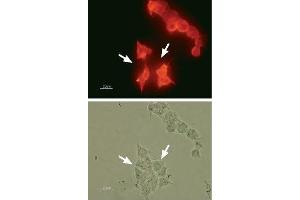 Expression of KV11. (KCNH2 antibody  (Intracellular))
