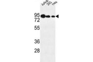 Western Blotting (WB) image for anti-Nucleolar Protein 9 (NOL9) antibody (ABIN3004375)