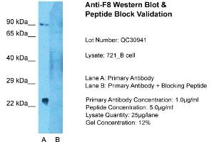 Host: Rabbit  Target Name: F8  Sample Tissue: 721_B Whole Cell  Lane A:  Primary Antibody Lane B:  Primary Antibody + Blocking Peptide Primary Antibody Concentration: 1 µg/mL Peptide Concentration: 2 µg/mL Lysate Quantity: 241 µg/laneGel Concentration: 2. (Factor VIII antibody  (C-Term))