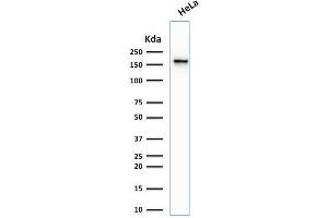 Western Blotting (WB) image for anti-Topoisomerase (DNA) II alpha 170kDa (TOP2A) (AA 1352-1493) antibody (ABIN6940773)