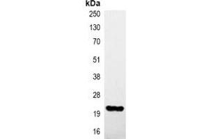 Immunoprecipitation of HA-tagged protein from HEK293T cells transfected with vector overexpressing HA tag, using Anti-HA-tag Antibody. (HA-Tag antibody)