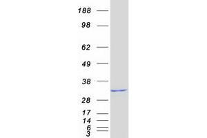 Validation with Western Blot
