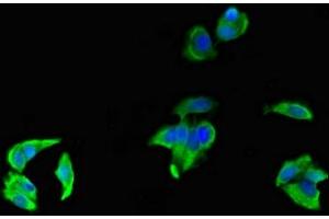 Immunofluorescent analysis of MCF-7 cells using ABIN7158547 at dilution of 1:100 and Alexa Fluor 488-congugated AffiniPure Goat Anti-Rabbit IgG(H+L) (FCGR3A antibody  (AA 49-184))