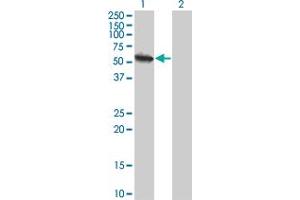 Western Blot analysis of USP3 expression in transfected 293T cell line by USP3 monoclonal antibody (M01), clone 1H2. (USP3 antibody  (AA 421-520))
