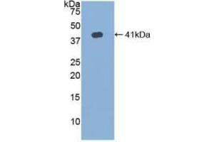 Detection of Recombinant HJV, Human using Polyclonal Antibody to Hemojuvelin (HJV) (HFE2 antibody  (AA 41-386))