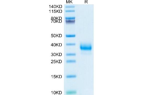 FCGR2B Protein (AA 46-224) (His tag)