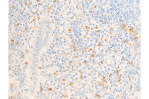 Immunohistochemistry (IHC) image for anti-Intercellular Adhesion Molecule 1 (ICAM1) (pTyr512) antibody (ABIN6255938)