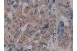 Immunohistochemistry (IHC) image for anti-Microfibrillar Associated Protein 2 (MFAP2) (AA 6-162) antibody (ABIN7442855)