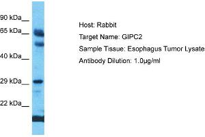 Host: Rabbit Target Name: GIPC2 Sample Type: Esophagus Tumor lysates Antibody Dilution: 1. (GIPC2 antibody  (C-Term))