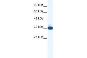 WB Suggested Anti-HTR1B Antibody Titration:  1. (5HT1B Receptor antibody  (N-Term))