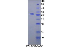 Image no. 1 for Surfactant Associated Protein A2 (SFTPA2) (AA 21-248) protein (His tag) (ABIN6238311) (SFTPA2 Protein (AA 21-248) (His tag))