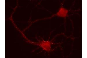Indirect immunostaining of hippocampus neurons (dilution 1 : 500). (GABRA2 antibody  (AA 29-37))