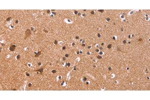 Immunohistochemistry of paraffin-embedded Human brain tissue using CSNK1D Polyclonal Antibody at dilution 1:50 (Casein Kinase 1 delta antibody)