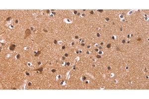 Immunohistochemistry of paraffin-embedded Human brain tissue using CSNK1D Polyclonal Antibody at dilution 1:50 (Casein Kinase 1 delta antibody)