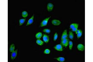 Immunofluorescent analysis of A549 cells using ABIN7161731 at dilution of 1:100 and Alexa Fluor 488-congugated AffiniPure Goat Anti-Rabbit IgG(H+L) (NPC2 antibody  (AA 20-151))