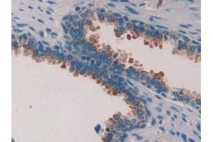 DAB staining on IHC-P; Samples: Human Prostate Tissue (PLAA antibody  (AA 534-792))
